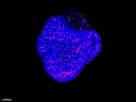 Organoid 