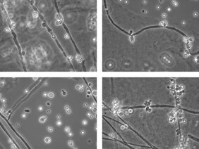 Lichtmikroskopische Bilder des Hefepilzes Candida 
