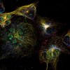 Acht verschiedene Proteine, die mittels NanoFLex in unsterblichen menschlichen Zellen nachgewiesen wurden: Tom20 und pmp70 in Hellblau, Nup50 und GALNT2 in Grün, Tubulin und Lamin in Gelb, Clathrin in Rot und Vimentin in Dunkelblau Acht verschiedene Proteine, die mittels NanoFLex in unsterblichen menschlichen Zellen nachgewiesen wurden: Tom20 und pmp70 in Hellblau, Nup50 und GALNT2 in Grün, Tubulin und Lamin in Gelb, Clathrin in Rot und Vimentin in Dunkelblau