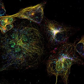 Acht verschiedene Proteine, die mittels NanoFLex in unsterblichen menschlichen Zellen nachgewiesen wurden: Tom20 und pmp70 in Hellblau, Nup50 und GALNT2 in Grün, Tubulin und Lamin in Gelb, Clathrin in Rot und Vimentin in Dunkelblau Acht verschiedene Proteine, die mittels NanoFLex in unsterblichen menschlichen Zellen nachgewiesen wurden: Tom20 und pmp70 in Hellblau, Nup50 und GALNT2 in Grün, Tubulin und Lamin in Gelb, Clathrin in Rot und Vimentin in Dunkelblau