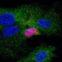 Untersuchungen zur angeborenen Immunantwort nach HBV-Infektion; blau: Zellkerne von Hepatozyten, rot: Kernprotein des Hepatitis-B-Virus (HBc-Antigen), grün: Marker für Immunaktivierung (IRF-3).