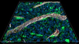 Immunbotenstoff Interferon gamma