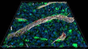 Immunbotenstoff Interferon gamma