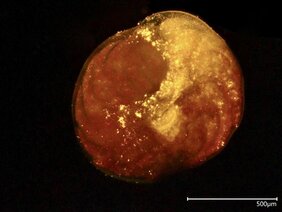 	Die große Anzahl fluoreszierender gelber Punkte in dieser Foraminifere sind aufgenommene Nanoplastikteilchen