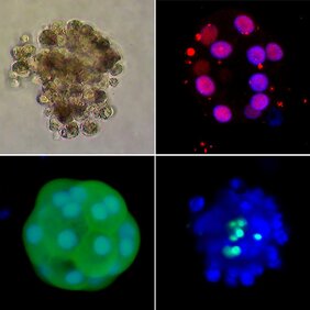 Mikroskopische Aufnahmen sogenannter humaner Organoide mit Leberzellen