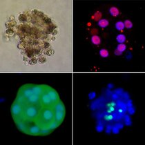 Mikroskopische Aufnahmen sogenannter humaner Organoide mit Leberzellen