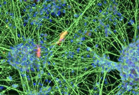 Nervenzellen, erzeugt durch Differenzierung von aus dem Blut gewonnenen induzierten neuralen Stammzellen Nervenzellen, erzeugt durch Differenzierung von aus dem Blut gewonnenen induzierten neuralen Stammzellen