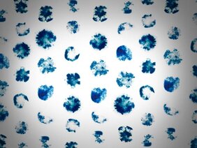 CRISPR-Cas-System 