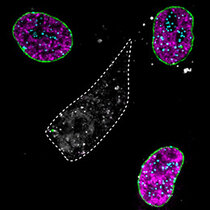 Bei der mittleren Zelle (grau) wurden gezielt gleich drei verschiedene Protein entfernt, ein Protein der Zellkernhülle (Lamin A, grün), ein Chromatinprotein (CENPA, türkis) und das Replikationsprotein (PCNA, magenta). 