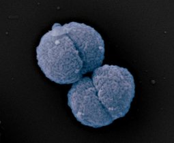 Bild von Neisseria gonorrhoeae (Gonokokken), der Erreger der Gonorrhö (Tripper). 