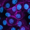 Die Zellkerne der Hautzellen (Keratinozyten) können mithilfe von eingefärbter DNA (DAPI, blau) sichtbar gemacht werden.