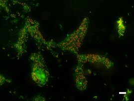 Acinetobacter baumannii-Bakterien 