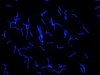 Der blau fluoreszierende Erreger Borrelia recurrentis in Kultur.