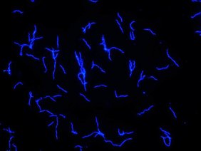 Der blau fluoreszierende Erreger Borrelia recurrentis in Kultur. Der blau fluoreszierende Erreger Borrelia recurrentis in Kultur.