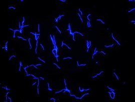 Der blau fluoreszierende Erreger Borrelia recurrentis in Kultur.