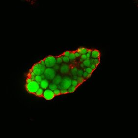 Lipidtropfen (angefärbt) in einer Fettzelle ohne EHD2. 