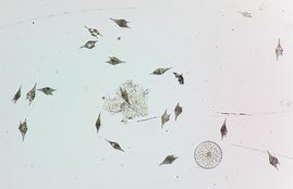 Die Mikroskopaufnahme zeigt überwiegend Dinoflagellaten der Gattung Triops