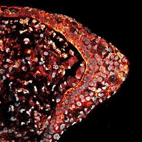 Hochauflösende Fluoreszenzmikroskopie eines Gewebequerschnitts, die Zellgrenzen (rot) und Zellkerne (grau) hervorhebt.  