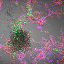 Kombinierte Hellfeld- und Fluoreszenzmikroskopie von Rinderzellen: Zellkerne (blau, DAPI), Cytoskelett (rot, Phalloidin) und aufgenommene Polystyrol-Nanoplastikpartikel (grün)