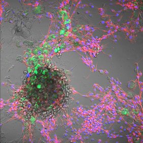 Kombinierte Hellfeld- und Fluoreszenzmikroskopie von Rinderzellen: Zellkerne (blau, DAPI), Cytoskelett (rot, Phalloidin) und aufgenommene Polystyrol-Nanoplastikpartikel (grün)