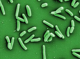 Elektronenmikroskopische Aufnahme von Pseudomonas aeruginosa 