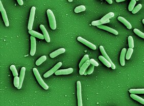 Elektronenmikroskopische Aufnahme von Pseudomonas aeruginosa 