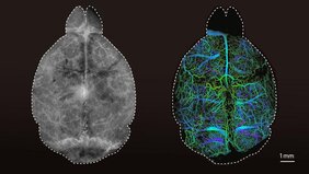 Fluoreszenzbilder eines Gehirns  