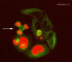 Der Ausfall des Reparaturenzyms SPRTN in diesen kultivierten Zellen führt zu tödlichen Pannen bei der Zellteilung, indem etwa die Chromosomen (rot) auf drei statt auf zwei Tochterzellkerne verteilt werden (Pfeil). Der Ausfall des Reparaturenzyms SPRTN in diesen kultivierten Zellen führt zu tödlichen Pannen bei der Zellteilung, indem etwa die Chromosomen (rot) auf drei statt auf zwei Tochterzellkerne verteilt werden (Pfeil). Grün: Zellteilungsapparat/Cytoskelett