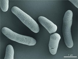 Corynebacterium glutamicum im Raster-Elektronenmikroskop. 
