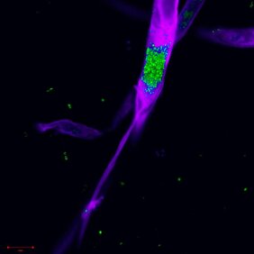 Mikroskopische Visualisierung der Bakterien im Pilz 