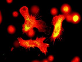 Immunzellen unter dem Fluoreszenzmikroskop: Blutstammzellen erinnern sich an einen früheren Angriff und produzieren mehr Immunzellen wie diese Makrophagen, um eine neue Infektion zu bekämpfen 