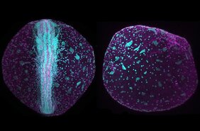 Killifisch-Embryos im Fluoreszenzmikroskop. Links mit ausgebildeter Achse, rechts ohne ausgeprägte Achse. 