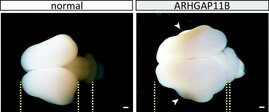 Wildtyp (normal) & ARHGAP11B-transgene fötale (101 Tage) Weißbüschelaffenhirne. Gelbe Linien, Grenzen der Großhirnrinde; weiße Linien, sich entwickelndes Kleinhirn; Pfeilspitzen, Gyri. Maßstab 1 mm.