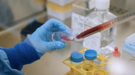 Blutproben werden im Labor untersucht und so entscheidende Veränderungen festgestellt.