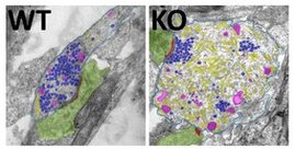Elektronenmikroskopische Aufnahme von Synapsen aus Wildtyp (WT) und Autophagie defizienten Mäusen (KO)