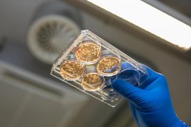 Zellkulturen auf einer Platte