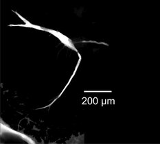 Mikroskopische Aufnahme der Mauthnerzelle eines Goldfisches 