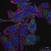 Die grünen Punkte in diesem Fluoreszenzbild zeigen die Bindung des Leukämie-assoziierten NPM1c Proteins an den Recycling-Regulator GABARAP