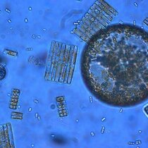 Phytoplankton aus dem Südlichen Ozean