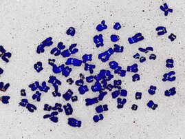Chromosomen (blau) mit am Zentromer lokalisierten Proteinen (grün, rot)