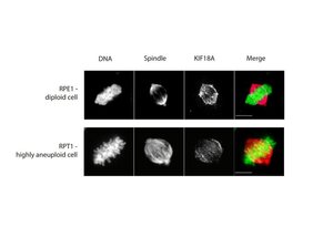 Teilung einer normalen Zelle (oben) und einer Zelle mit abnormal hoher Anzahl an Chromosomen