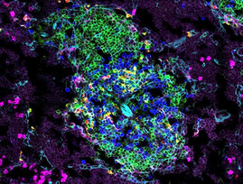 Mikroskopische Analyse von dendritischen Zellen (rot/gelb) und T-Zellen (blau) in der Milz von neugeborenen, 8 Tage alten Mäusen. 