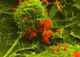 Meningokokken (orange) haben sich an menschliche Wirtszellen (grün) angeheftet. Rasterelektronenmikroskopische Aufnahme in Falschfarbendarstellung.  