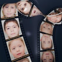Photorealistische, synthetische Porträts unterschiedlicher Erkrankungen, die im Kontext der Studie diagnostiziert wurden. 