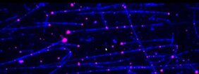 RNA-Transport in einer Zelle