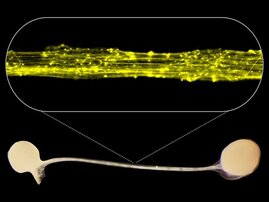 Mikroskopisches Bild von Axonen mit großer Reichweite, die zwei Gehirnorganoide verbinden. 