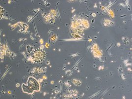 Symbolbild einer Algengemeinschaft