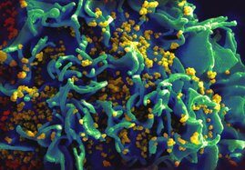 REM-Aufnahme von HIV-Partikeln