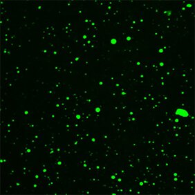 Substrat-induzierte Tröpfchenbildung einer pflanzlichen TIR-Domäne in vitro. Zu sehen sind grüne Punkte auf schwarzem Hintergrund