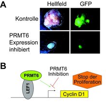 PRMT6-Inhibition als Ansatzpunkt für eine molekulare Therapie von Krebserkrankungen